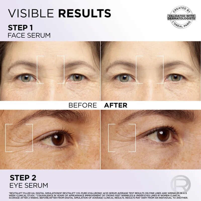 L’Oréal Paris Revitalift Filler комплект за грижа за лице за зоната на лицето и очите