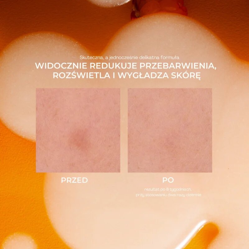 Lumene Nordic-C [VALO] Dark Spot Serum озаряващ серум с витамин С против пигментни петна 30 мл.