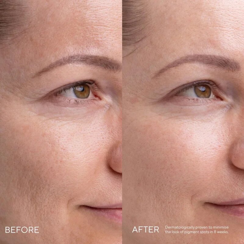 Mádara MÁDARA Kojic Alternative Pigment Serum серум против пигментни петна 30 мл.