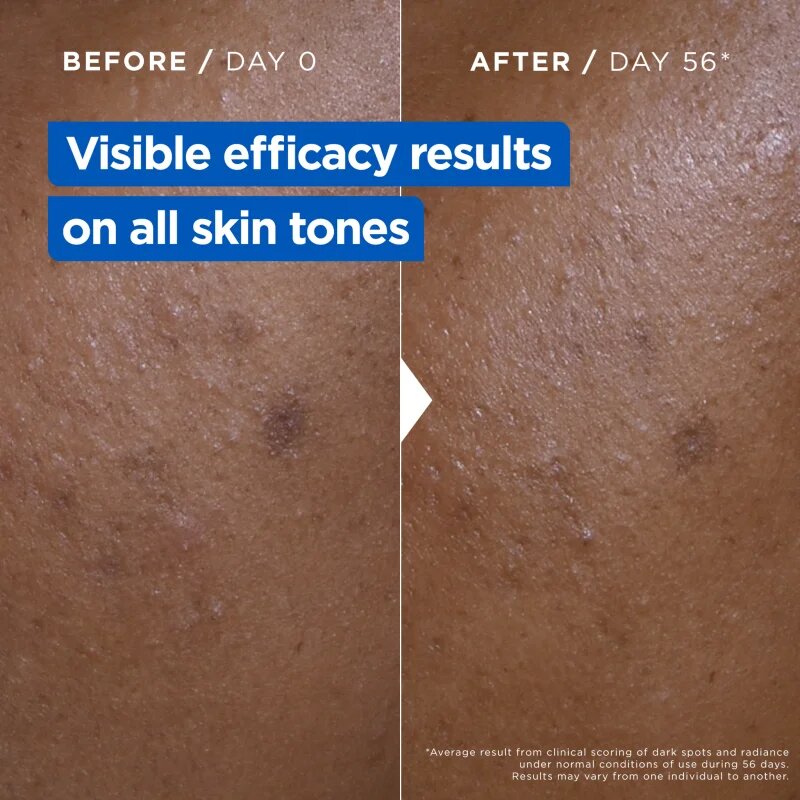 MIXA Niacinamide Bright интензивен хидратиращ крем Против тъмни петна 400 мл.
