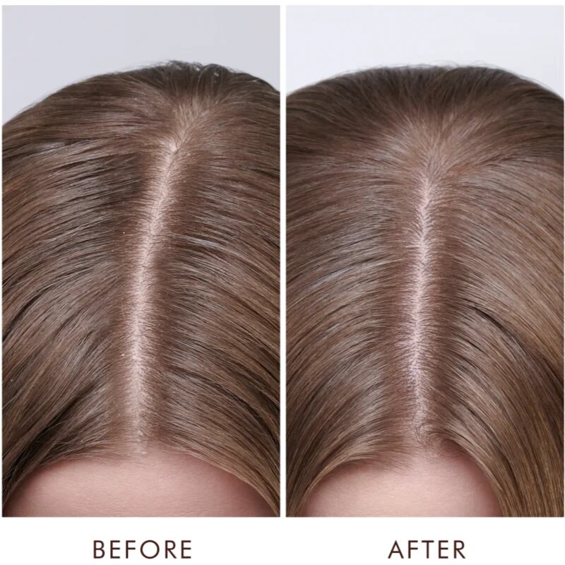 Moroccanoil Scalp Dry Scalp Treatment дълбоко подхранваща грижа за суха кожа 45 мл.