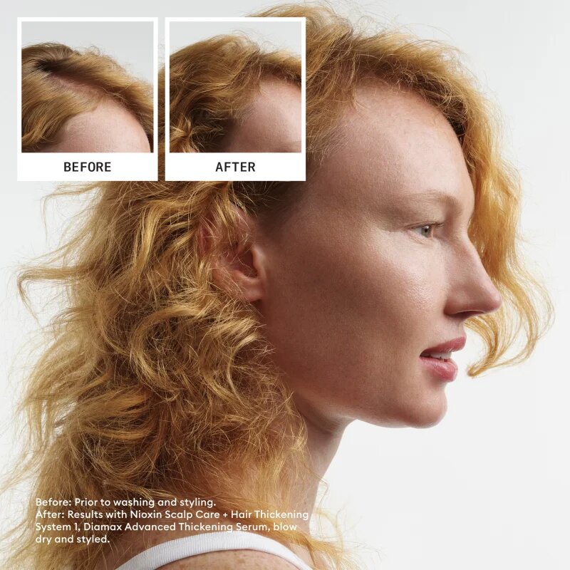 Nioxin System 1 подаръчен комплект за тънка и изтощена коса 3 бр.
