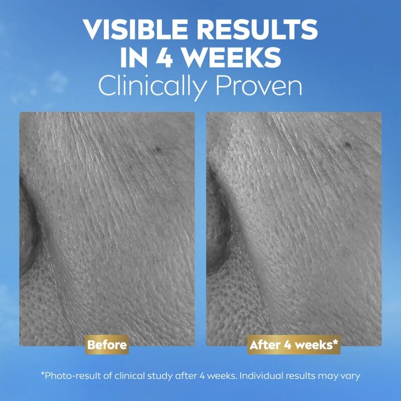 Nivea Q10 Anti-Wrinkle Collagen Expert серум против бръчки с колаген 30 мл.