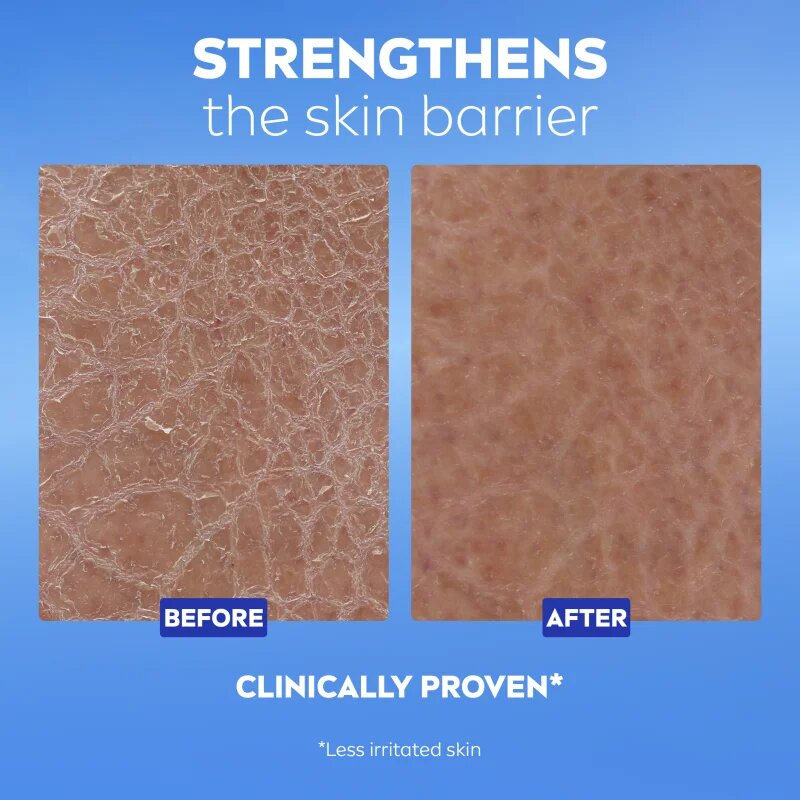 Nivea Repair & Care Urea регенериращ лосион за тяло за много суха кожа 400 мл.
