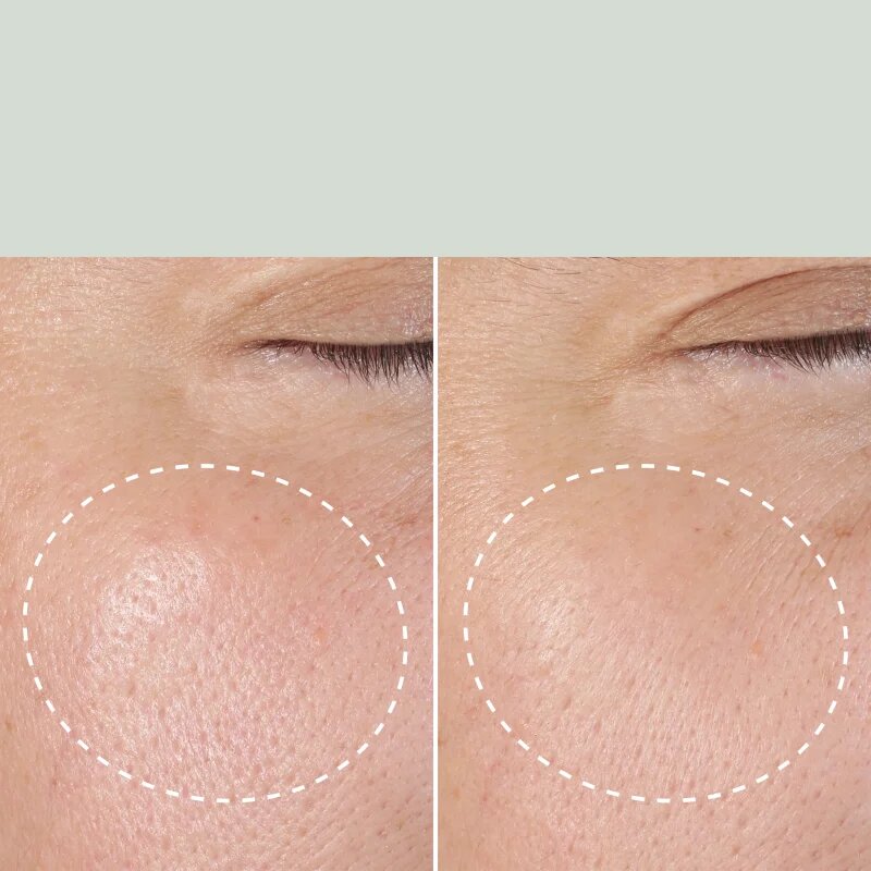 Origins Checks and Balances™ Daily Exfoliating Toner нежен ексфолиращ тоник 150 мл.