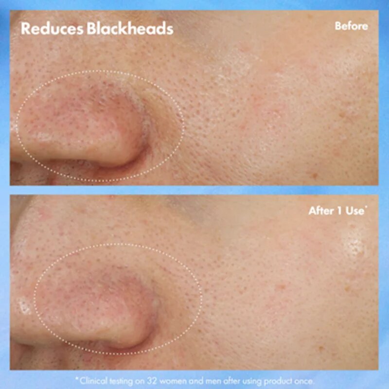 Origins Clear Improvement® Blackhead Clearing Mask-To-Scrub маска за почистване на порите от черни точки 75 мл.