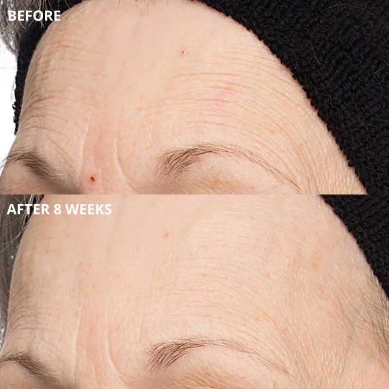 Perricone MD Cold Plasma Plus+ The Intensive Hydrating Complex интензивен хидратиращ гел 30 мл.