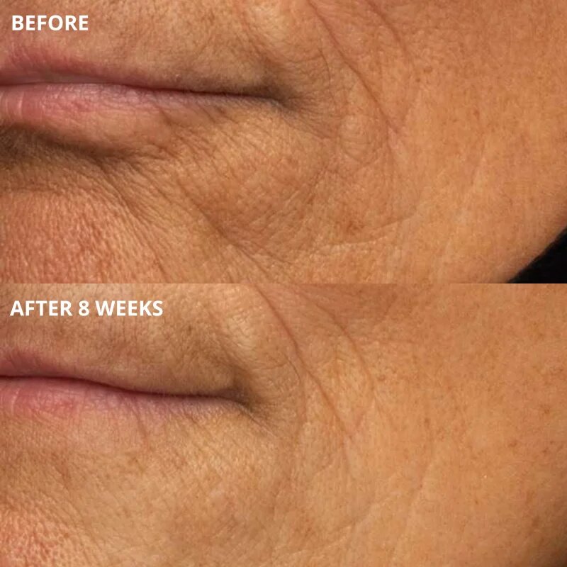 Perricone MD Cold Plasma Plus+ The Intensive Hydrating Complex интензивен хидратиращ гел 30 мл.