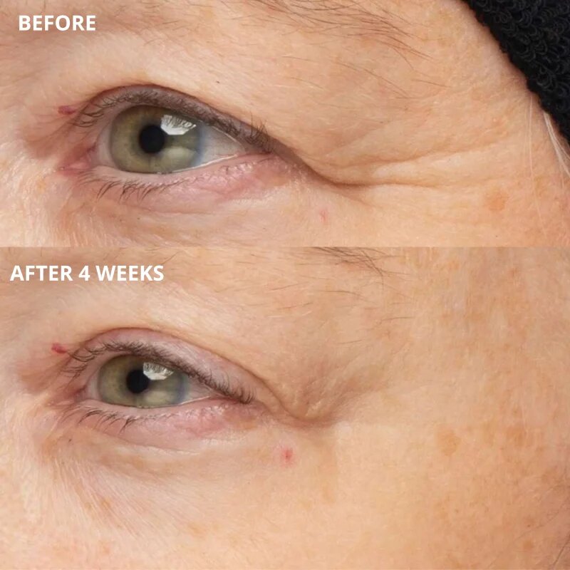 Perricone MD Cold Plasma Plus+ The Intensive Hydrating Complex интензивен хидратиращ гел 30 мл.