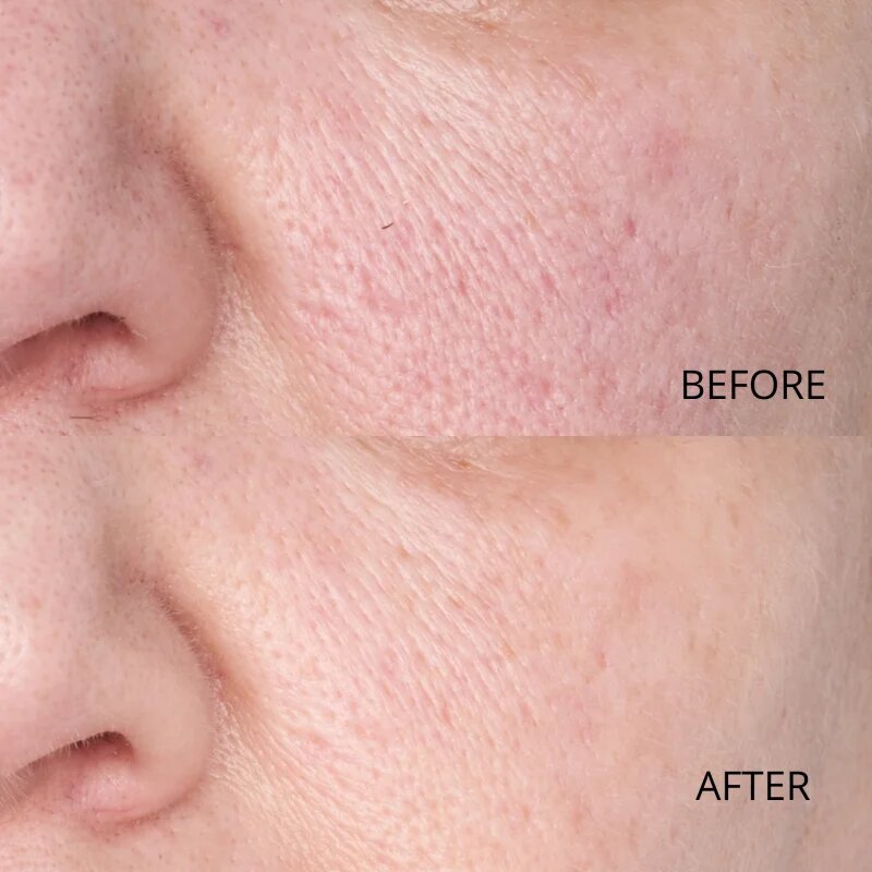 Perricone MD Hypoallergenic Clean Correction Smoothing Restorative Serum изглаждащ серум за хидратация и озаряване на кожата 59 мл.