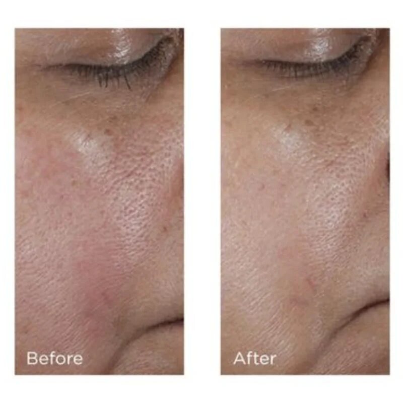 Perricone MD No:Rinse Pore Minimizing Toner интензивен тоник за изглаждане на кожата и минимизиране на порите 118 мл.