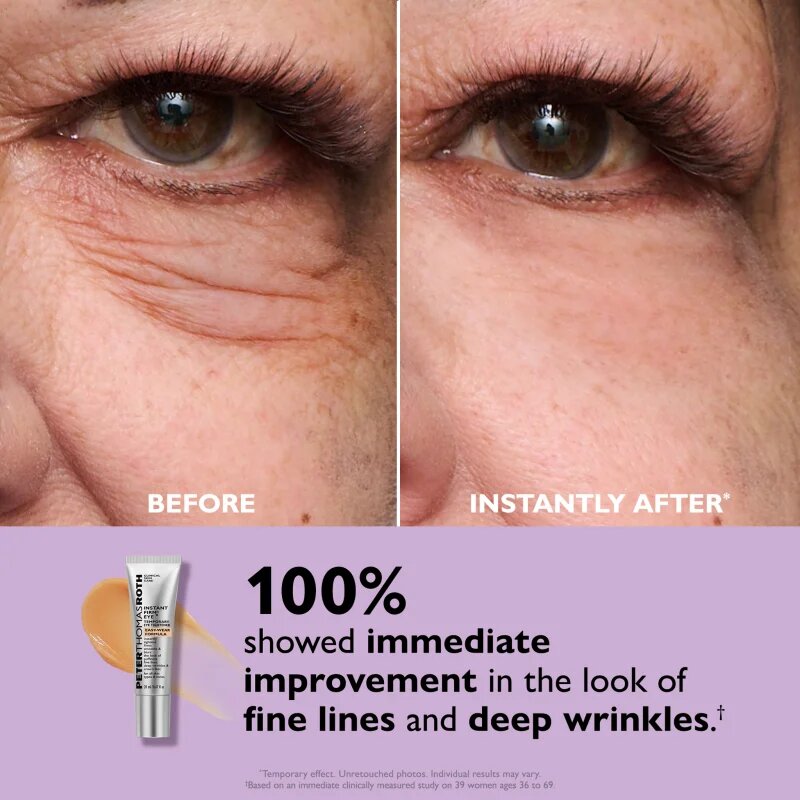 Peter Thomas Roth Instant FIRMx Eye околоочен крем за подмладяване на кожата на лицето 20 мл.