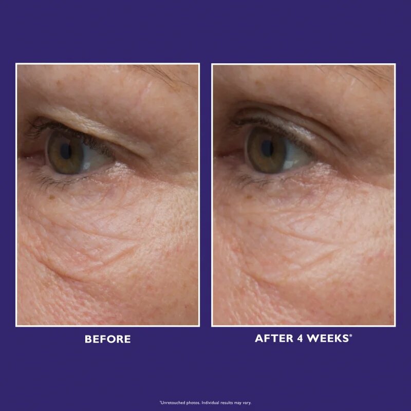 Peter Thomas Roth Ultimate Solution 5 Multitasking Eye Cream богат хидратиращ крем за очи 15 мл.