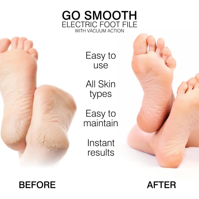 RIO Go Smooth Vacuum Action електрическа пила за пети 1 бр.
