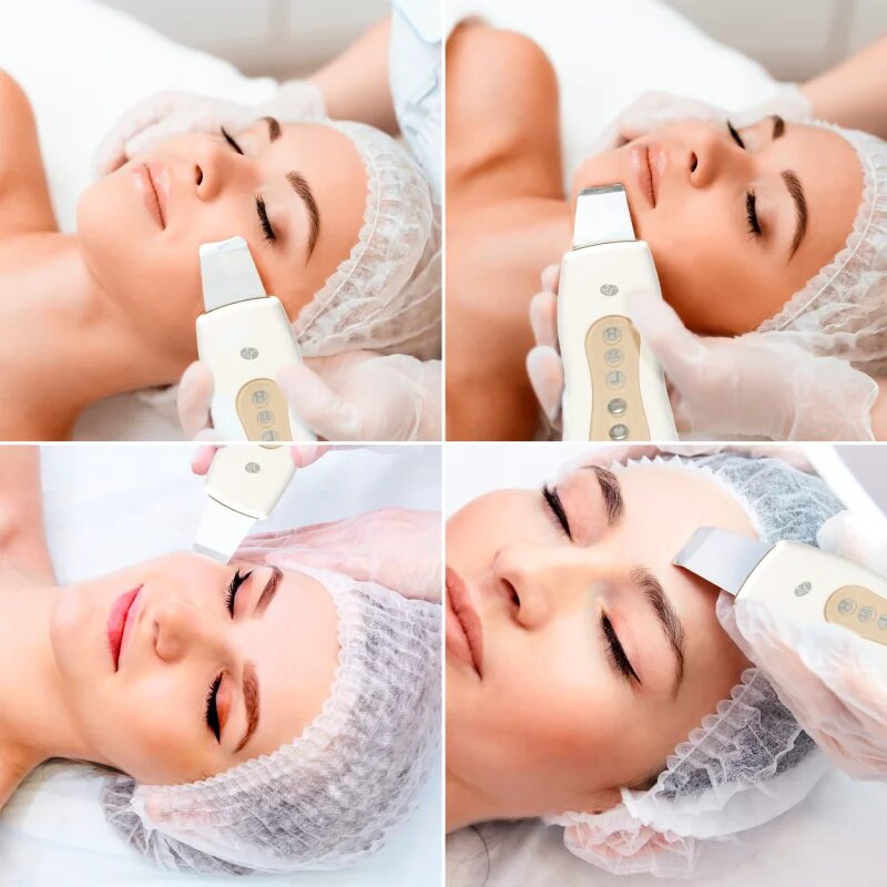 RIO Ultrasonic Facial уред за почистване на лице 1 бр.