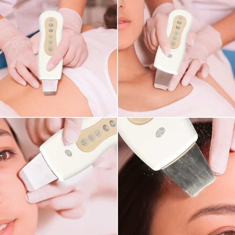 RIO Ultrasonic Facial уред за почистване на лице 1 бр.