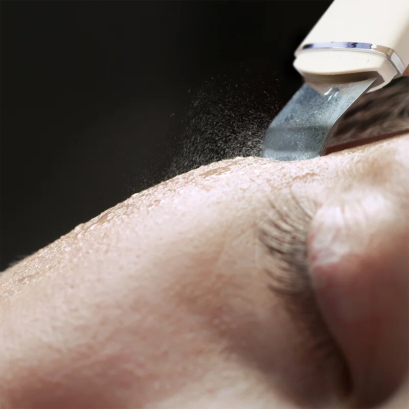 RIO Ultrasonic Skin Cleanser мултифункционална ултразвукова шпатула 1 бр.