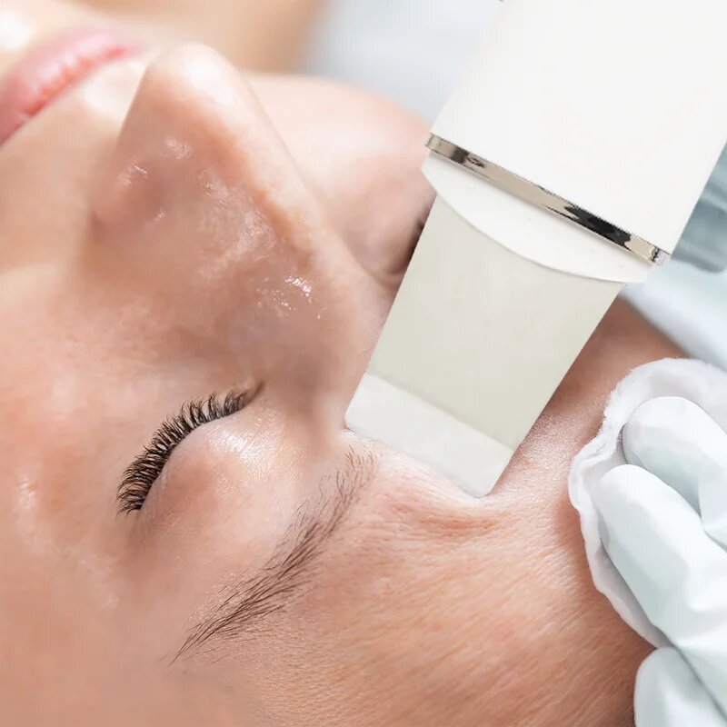 RIO Ultrasonic Skin Cleanser мултифункционална ултразвукова шпатула 1 бр.