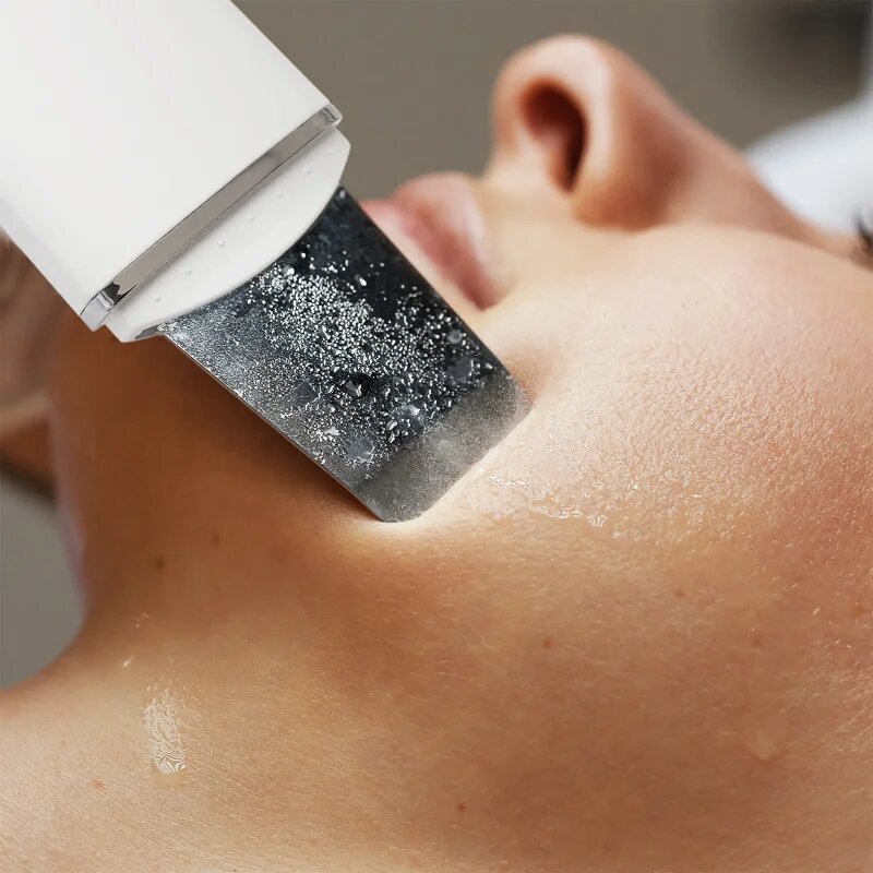 RIO Ultrasonic Skin Cleanser мултифункционална ултразвукова шпатула 1 бр.