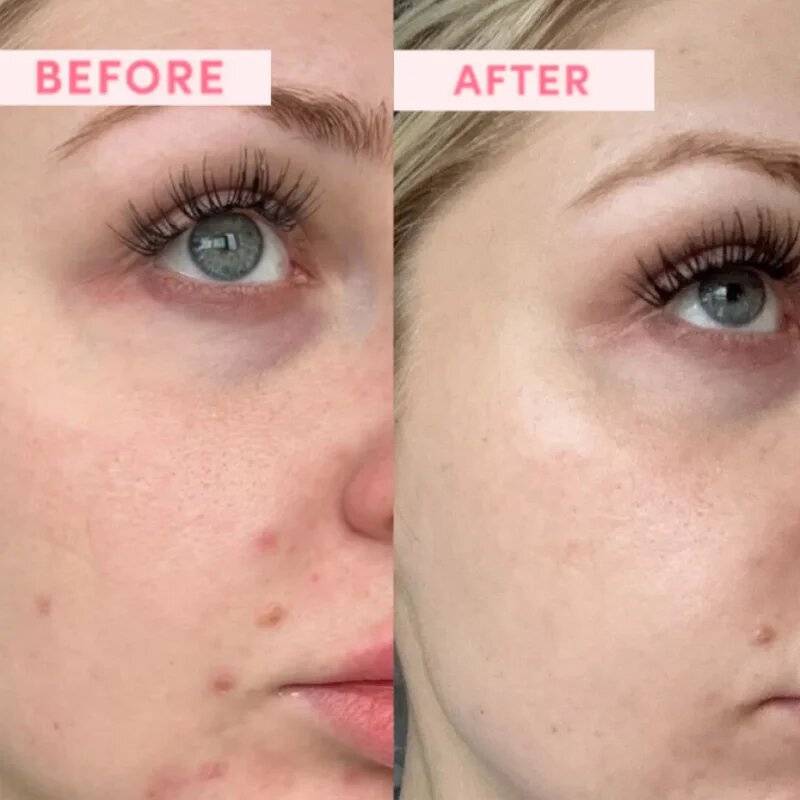 Sand & Sky Australian Emu Apple Resurfacing Mask изглаждаща маска за възобновяване на повърхността на кожата 60 гр.