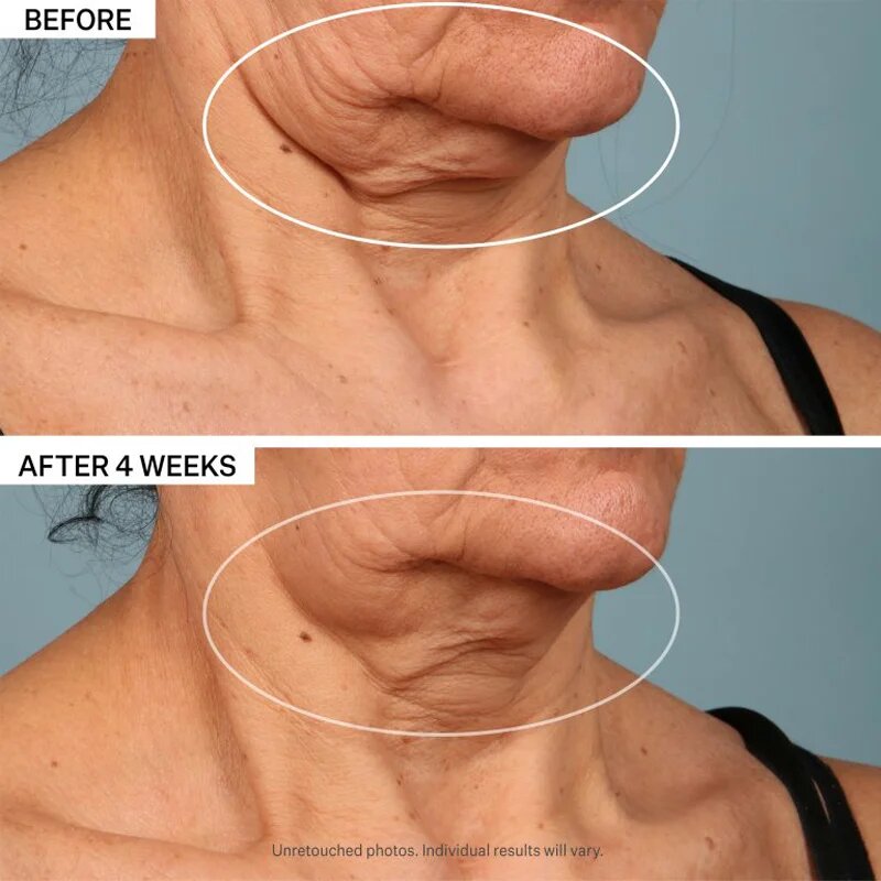 StriVectin Tighten & Lift TL Advanced Tightening Neck Cream Plus стягащ лифтинг крем за шия и деколте 30 мл.