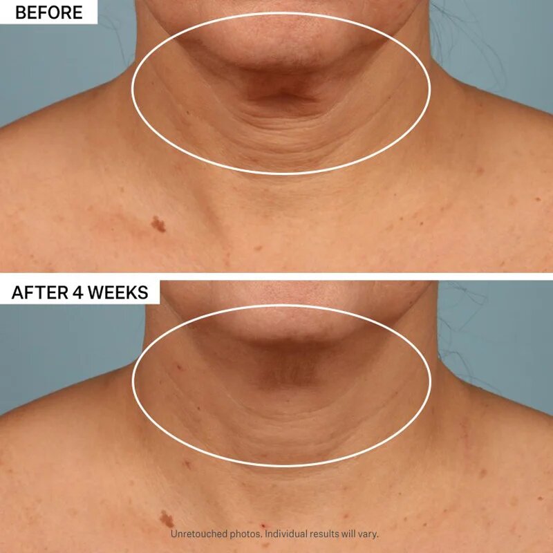 StriVectin Tighten & Lift TL Advanced Tightening Neck Cream Plus стягащ лифтинг крем за шия и деколте 50 мл.
