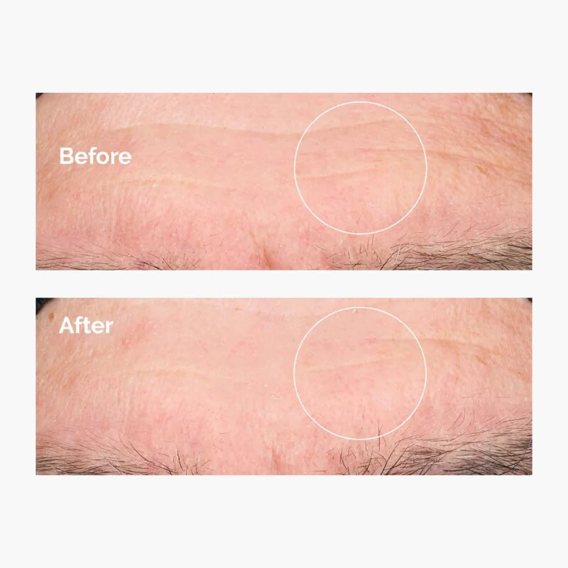 The Ordinary Hyaluronic Acid 2% + B5 хидратиращ серум с церамиди 30 мл.