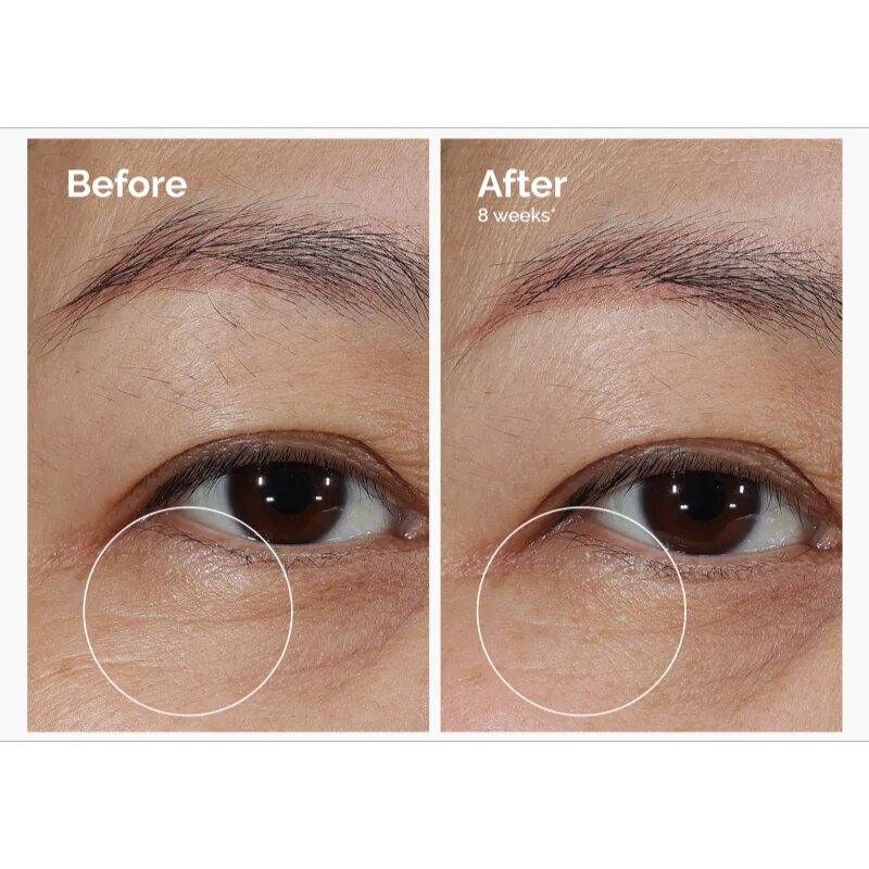 The Ordinary Lacto-PDRN* 4% + B9 Eye Cream изглаждащ околоочен крем против бръчки за околоочния контур 15 мл.