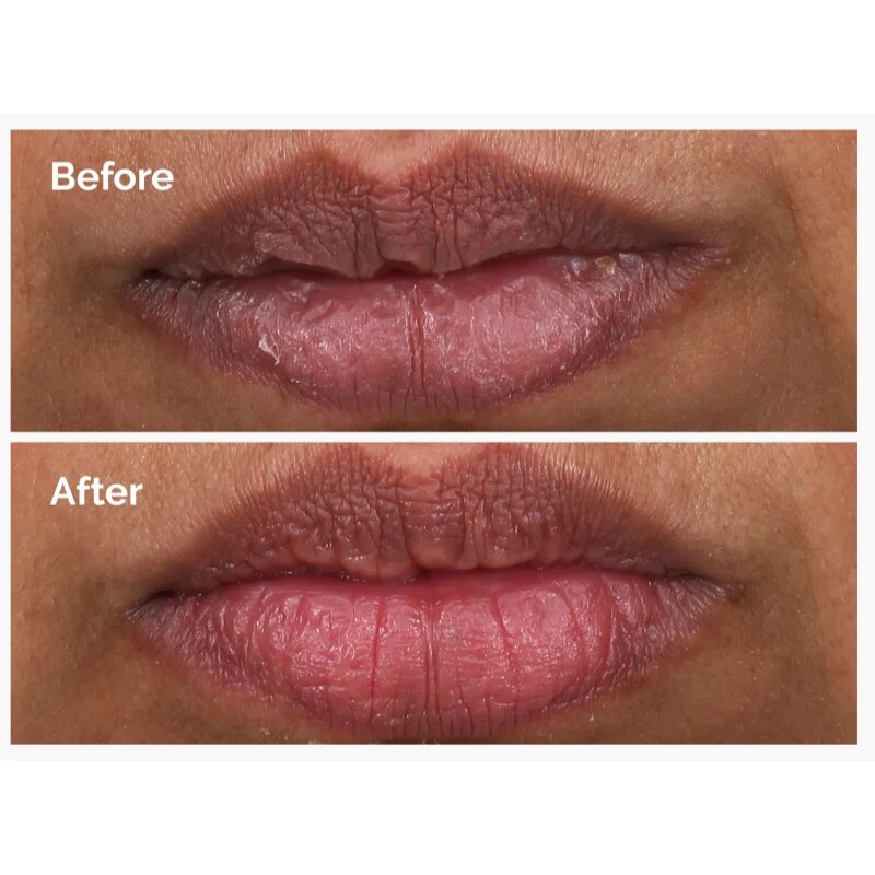 The Ordinary PHA 5% Exfoliating Lip Serum изглаждащ ексфолиращ серум за устни 15 мл.